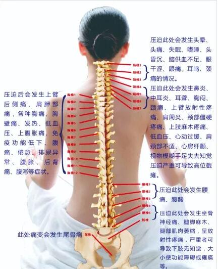 保護(hù)腰椎—示范腰椎保健操，趕快收藏吧